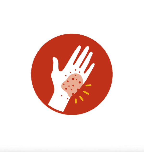 Advanced Skin Allergy Panel
